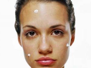 Effectieve gel voor acne en acne