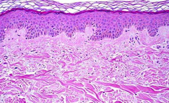 huid onder de microscoop