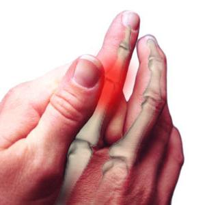 Artritis van de vingers: behandeling, oorzaken, symptomen
