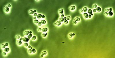 Candida albicans. Wat is het?