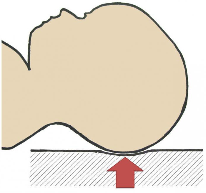 Dolichocephalische vorm van het hoofd: norm en pathologie