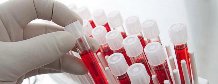 HCT in het bloedonderzoek: de norm bij kinderen, bij mannen en bij vrouwen. Wat betekent HCT in een bloedtest?