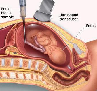 resus test