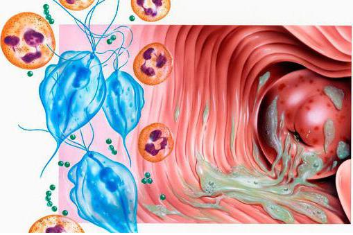 Trichomonas colpitis bij mannen en vrouwen symptomen