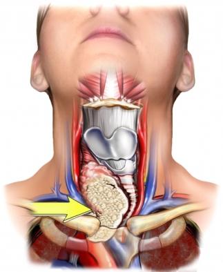 anatomie van de schildklier